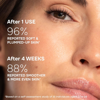SimplyVital Collagen, Retinol & Hyaluronic Acid Serum - Anti-Aging Moisturizer for Face, Neck & Décolleté - Made in USA, Deep Moisturizing Skin Care Complex - Hydrating Facial Serum for Women, 1 fl.oz - USA IMPORT -