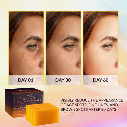 VALITIC - Kojic Acid Soap Stick to Remove Dark Spots, Vitamin C, Retinol, Collagen and Turmeric (Original Japanese)