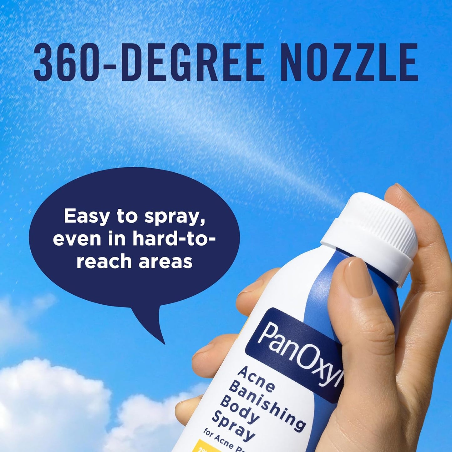 PanOxyl Acne Banishing Body Spray with 2% Salicylic Acid, Pimple Treatment Spray to Clear Stubborn Breakouts, 360-Degree Spray Nozzle, Skin-Brightening Niacinamide, Vitamin C, Witch Hazel, Aloe, 6 Oz - USA IMPORT -
