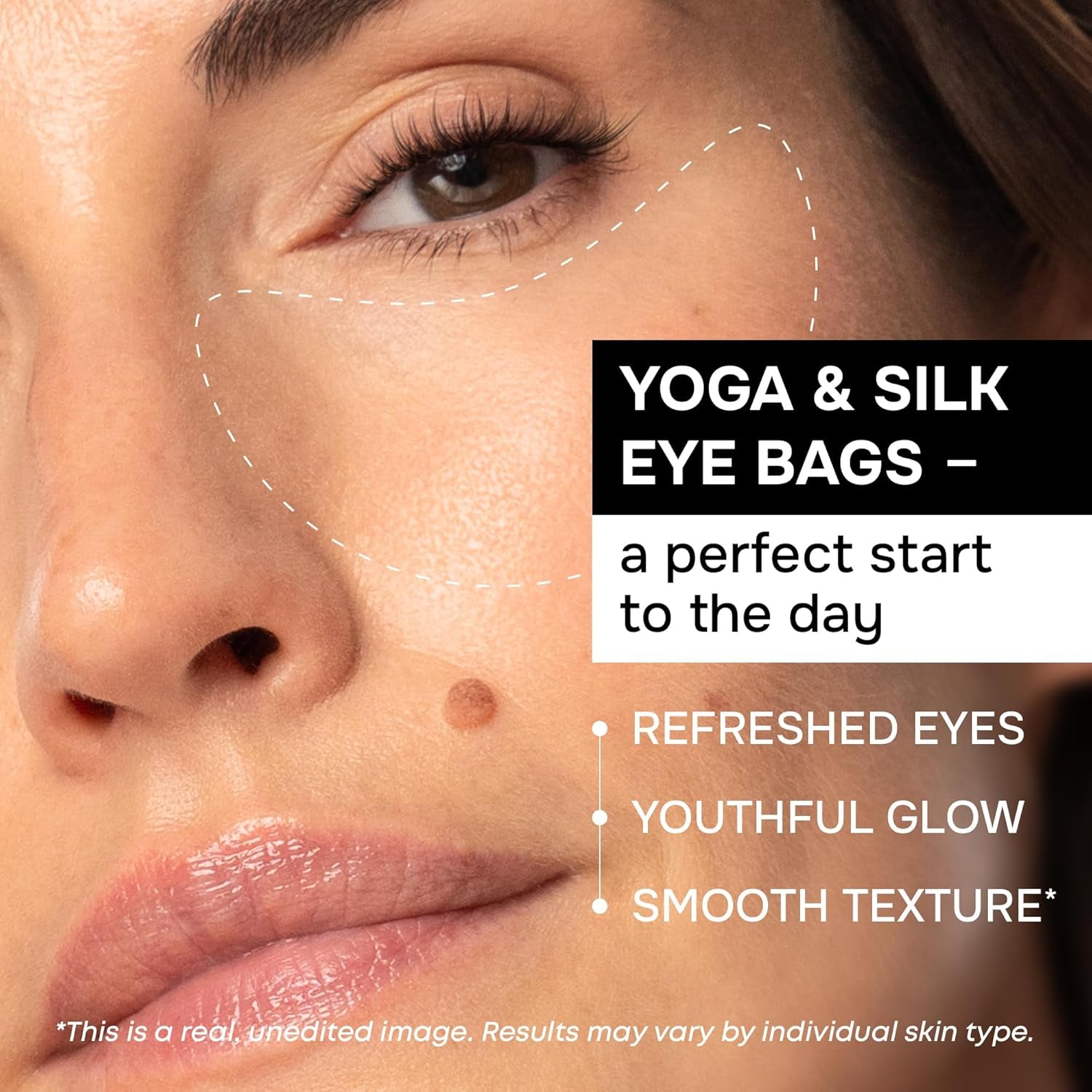 SimplyVital Under Eye Patches – Cooling Collagen & Retinol Gel Pads, 15 Pairs (USA Import)