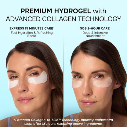 SimplyVital Under Eye Patches – Cooling Collagen & Retinol Gel Pads, 15 Pairs (USA Import)